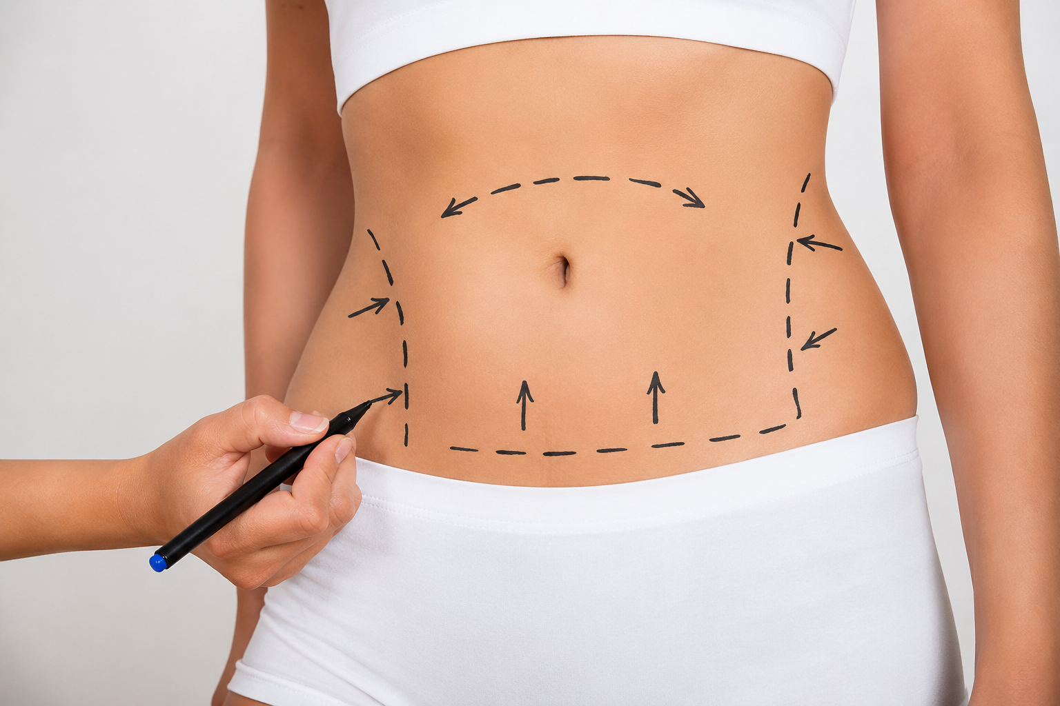 Liposuction Candidate